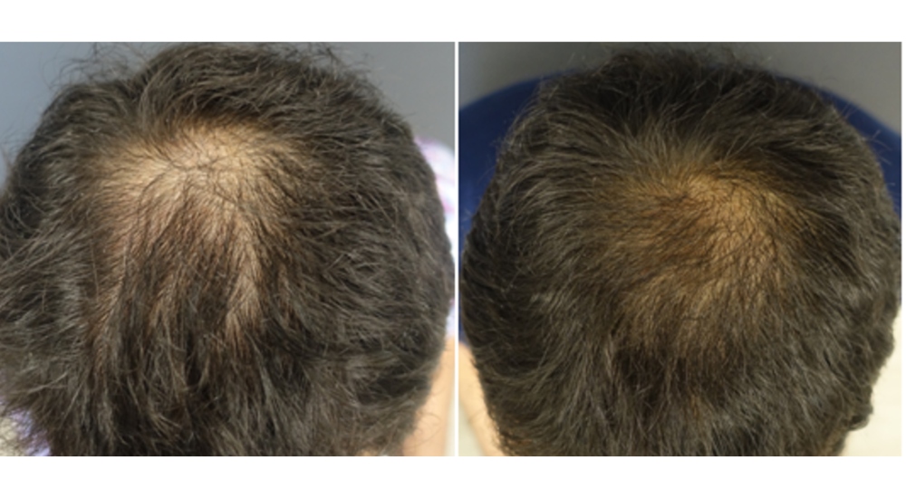 After Seven months of treatment