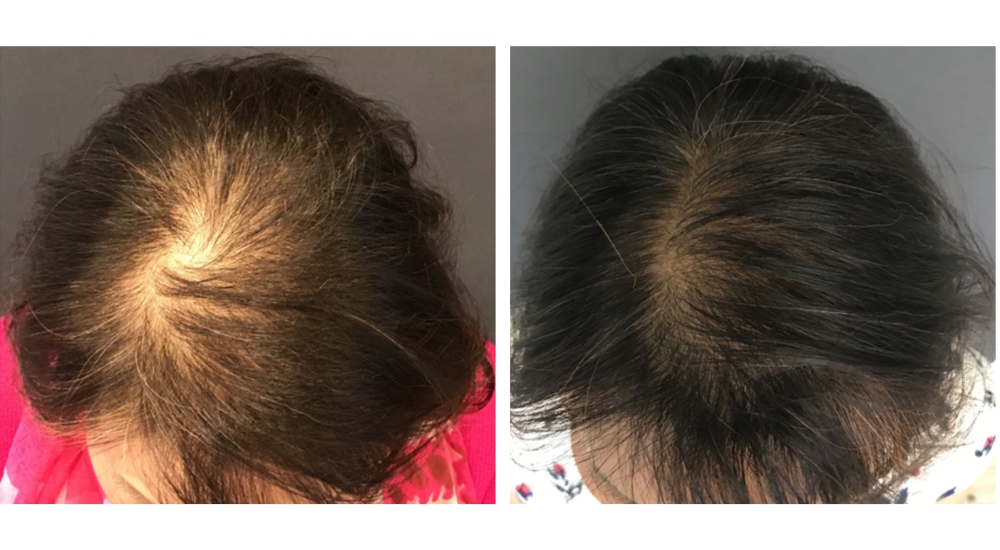 DE_RIVE hair Results